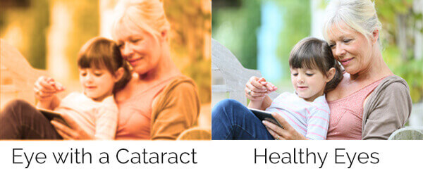 Normal vision vs vision with cataracts